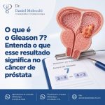 Saiba como interpretar o escore de Gleason 7, a diferença entre 3+4 e 4+3 e como esse resultado influencia o tratamento do câncer de próstata.