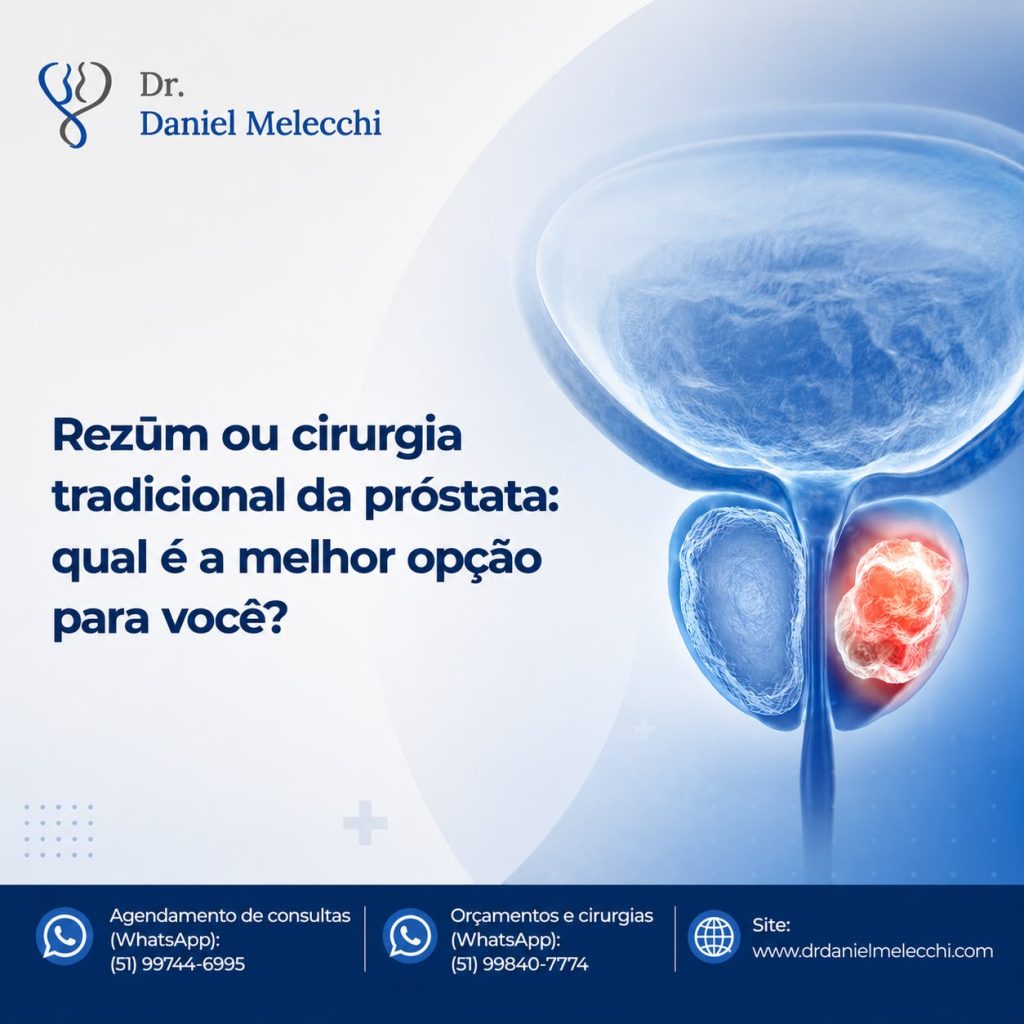 A resposta depende de diversos fatores, como o tamanho da próstata, a intensidade dos sintomas, a idade do paciente, seu estado de saúde e seus objetivos em relação à qualidade de vida.