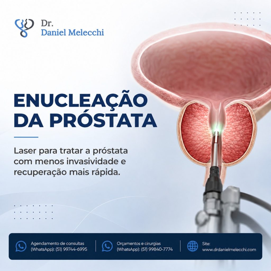 A técnica é realizada pela uretra, sem cortes externos, e pode ser utilizada inclusive em próstatas de grande volume.