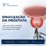 A técnica é realizada pela uretra, sem cortes externos, e pode ser utilizada inclusive em próstatas de grande volume.