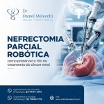 a nefrectomia parcial robótica pode ser uma alternativa cirúrgica que busca retirar o tumor preservando a maior quantidade possível de tecido renal saudável.